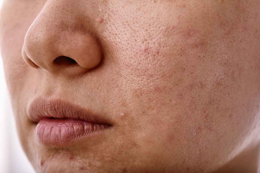 Congested Skin