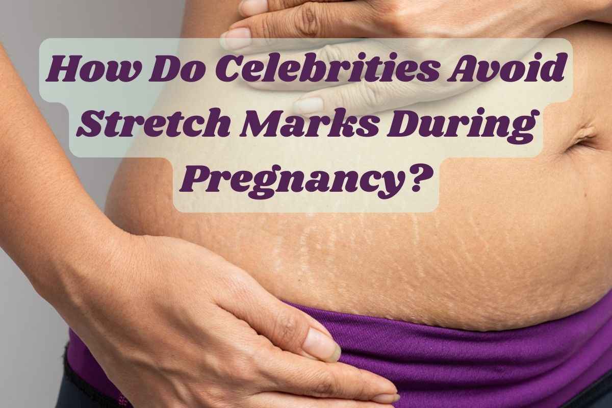 Stretch Marks During Pregnancy